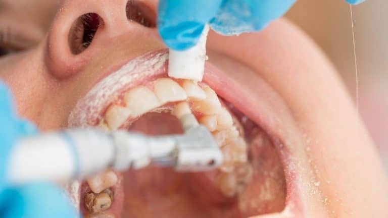 טיפול בנסיגת חניכיים