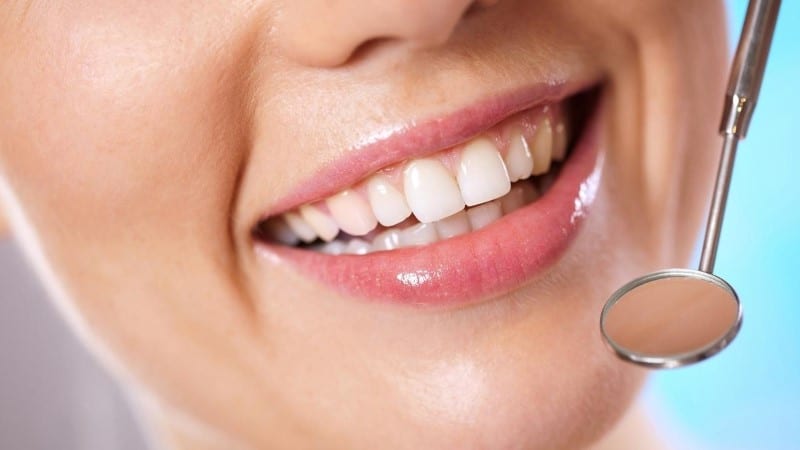 גשר שיניים שקוף